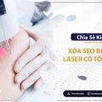 MÁY IPL TRỊ MỤN CÓ HIỆU QUẢ KHÔNG ? – 11